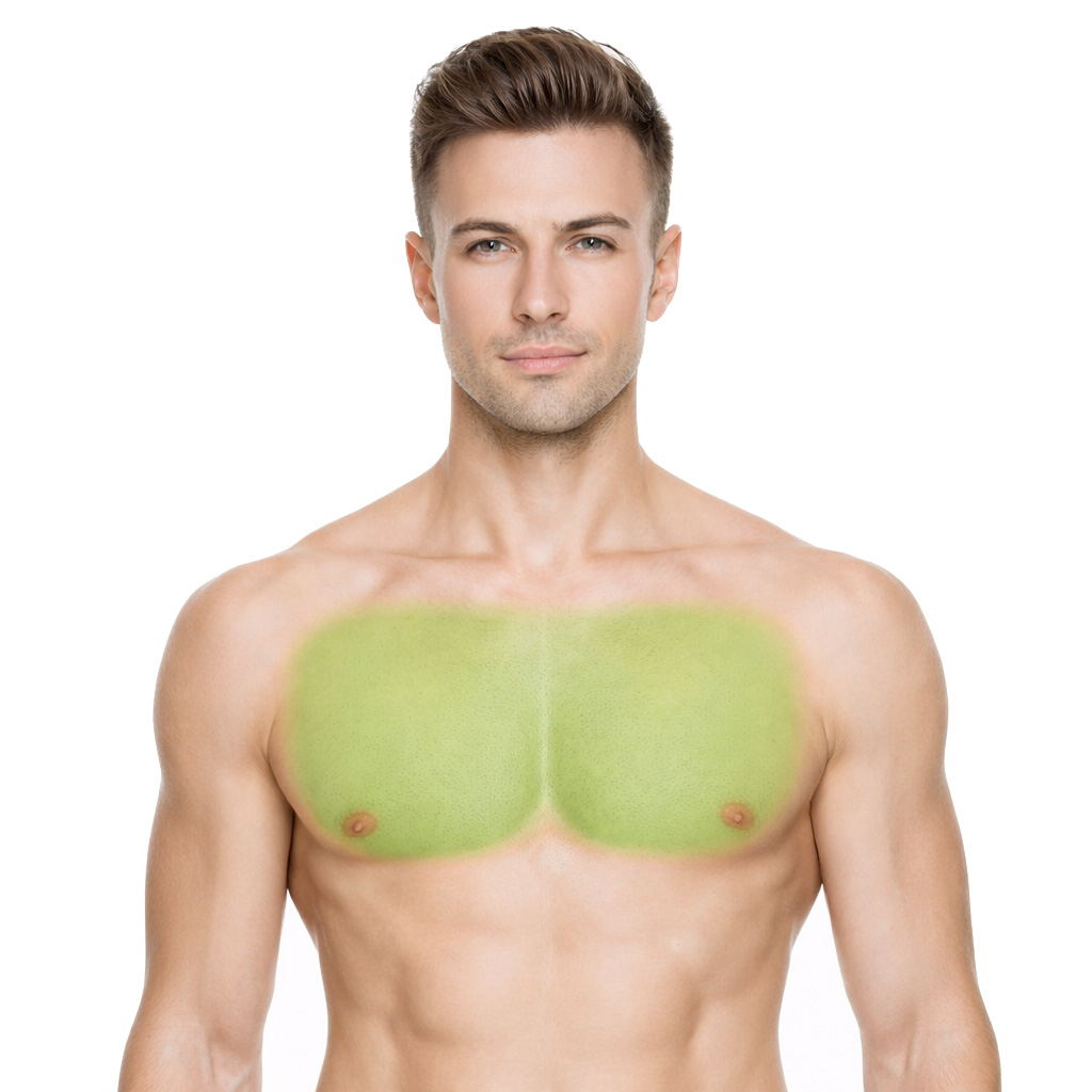 Chest Laser Hair Removal North York