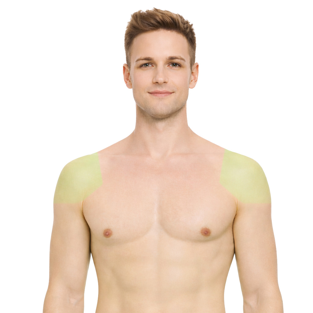 Shoulder Laser Hair Removal North York